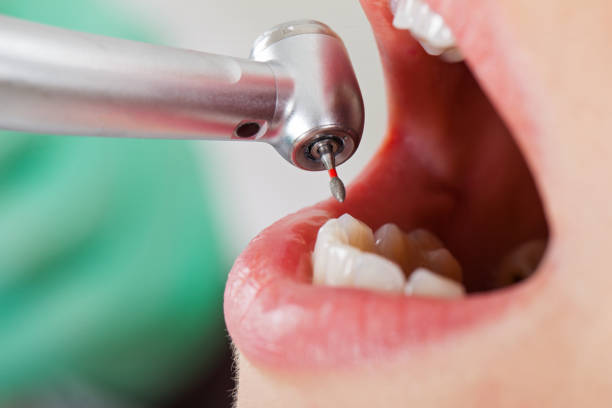 Best Emergency Broken Tooth Repair in Kaufman, TX